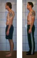 Casestudy1 Stopping Back Pain through Alignment Therapy