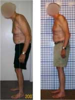 Casestudy2 Back Pain Treatment